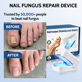 Zenvixer™ Nail Fungus Repair Device