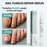 Botanical Aloe Vera Anti-Fungal Nail Serum