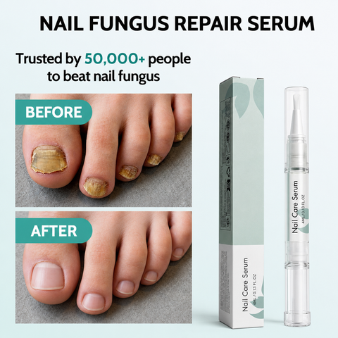Botanical Aloe Vera Anti-Fungal Nail Serum