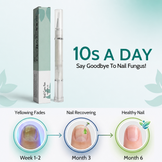 Botanical Aloe Vera Anti-Fungal Nail Serum
