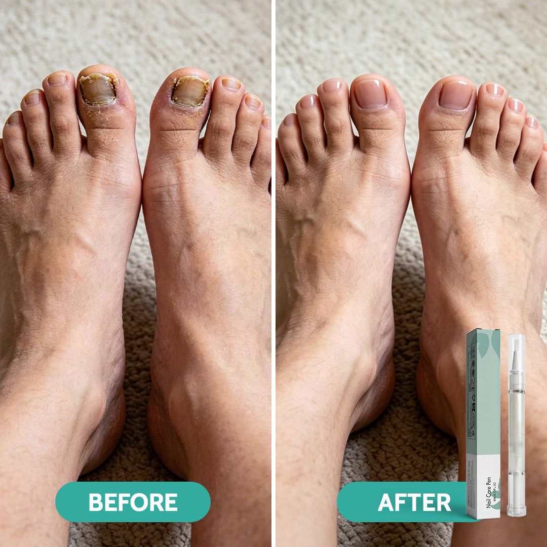Botanical Aloe Vera Anti-Fungal Nail Serum