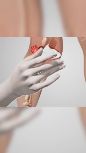 Video cover